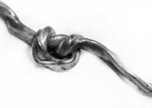 umbilical cord true knot